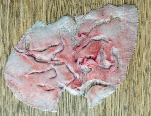 Hal's prosthetic wound